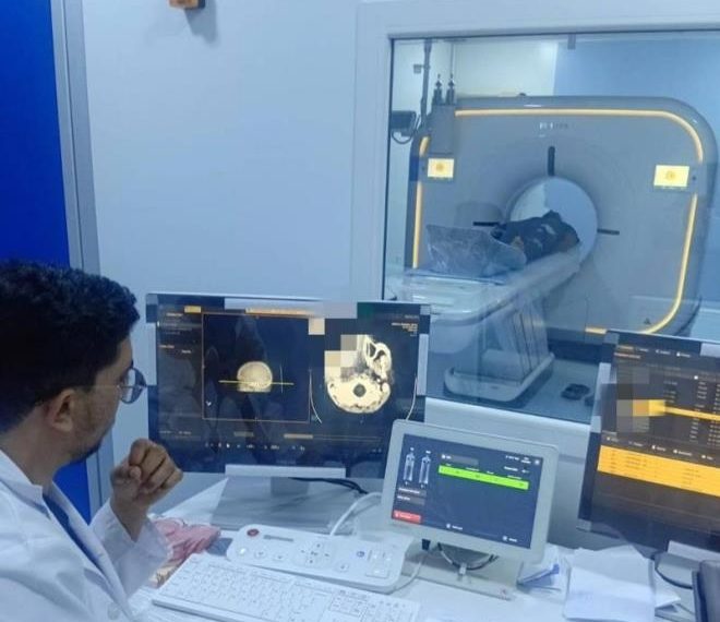 الطبّ عن بُعد يدعم خدمات التصوير الطبي بسبيطلة